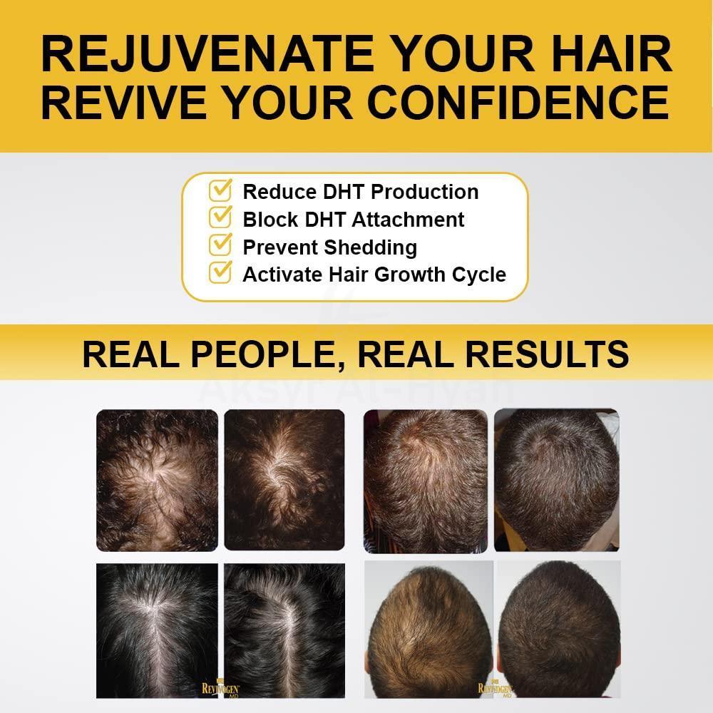 REVIVOGEN SCALP THERAPY KIT 60ML 3