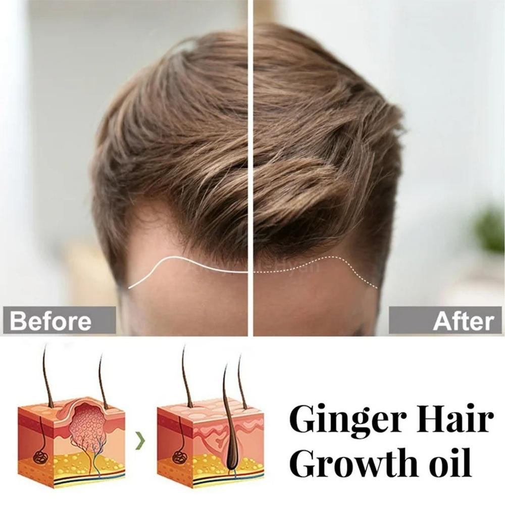 HAIRGROW 5% MINOXIDIL 50ML 4