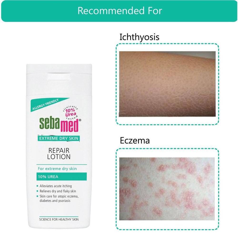 SM UREA 5% RELIEF SHAMPOO 200ML 5