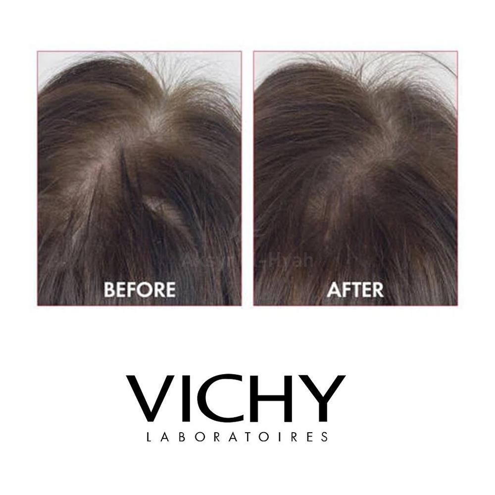 VICHY DERCOS AMINEXIL MEN  21X6ML(FM0018298) 4
