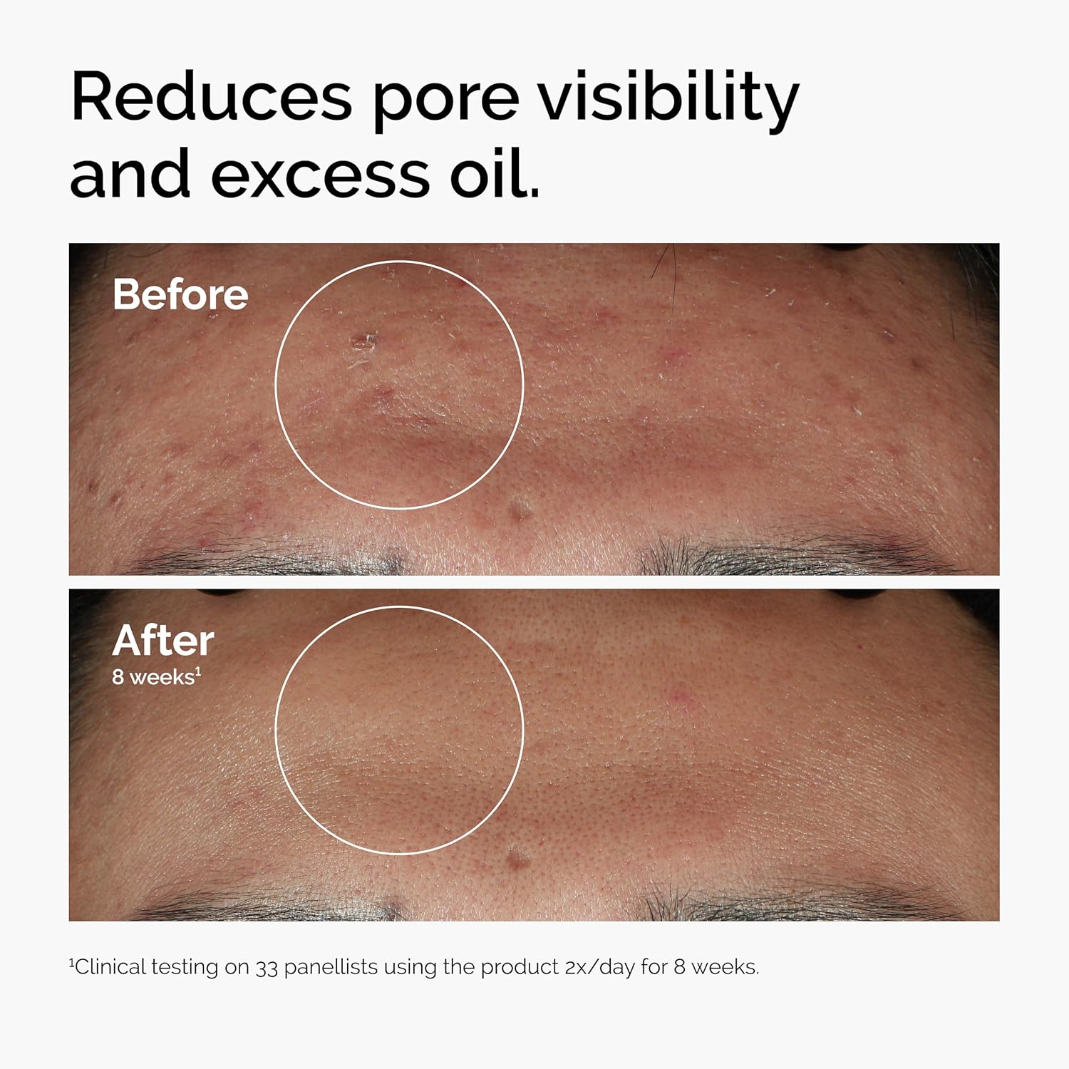 THE ORDINARY NIACINAMIDE10%+ZINC1%60ML 1