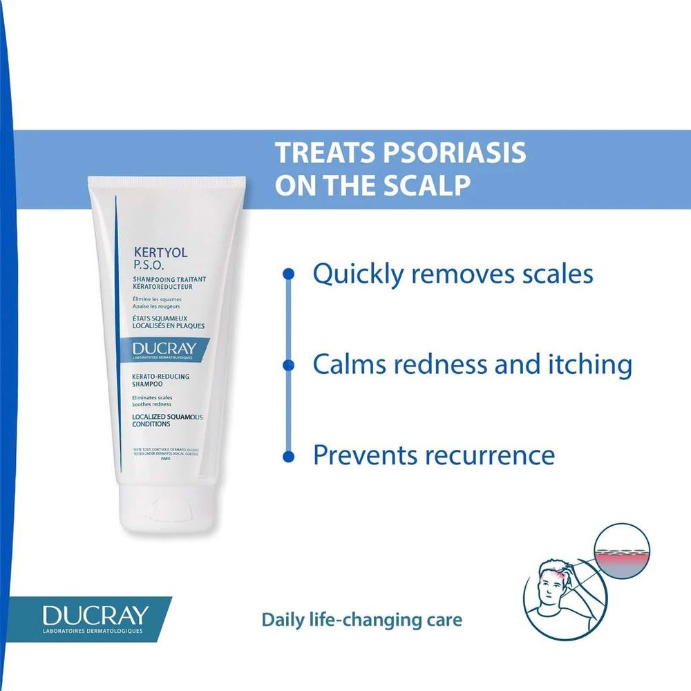 DUCRAY KERTYOL PSO SHAMPOO 200ML(573848) 1
