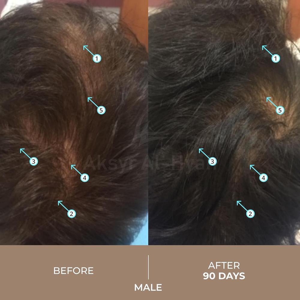 DS SPECTRAL DNC-N HAIR SUPPORT SYSTEM 60ML#11005 2