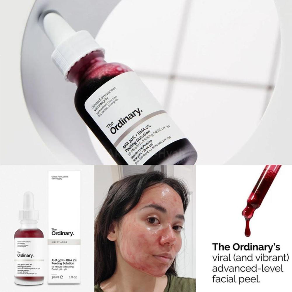 THE ORDINARY AHA30%BHA2% PEELING SOL30ML