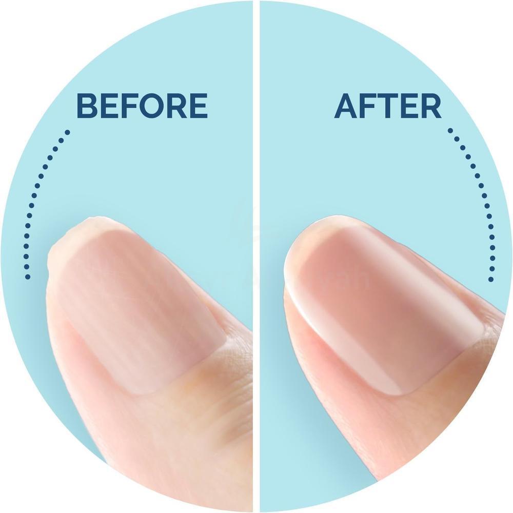 SCHOLL VELVET ELECTRONIC NAIL CARE SYSTEM