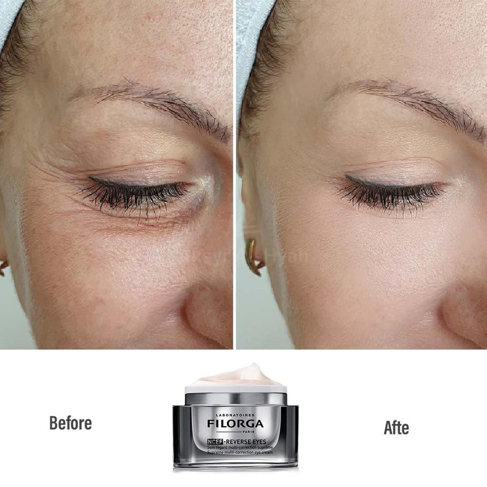 FILORGA NCEF REVERSE EYE CREAM 15ML 6