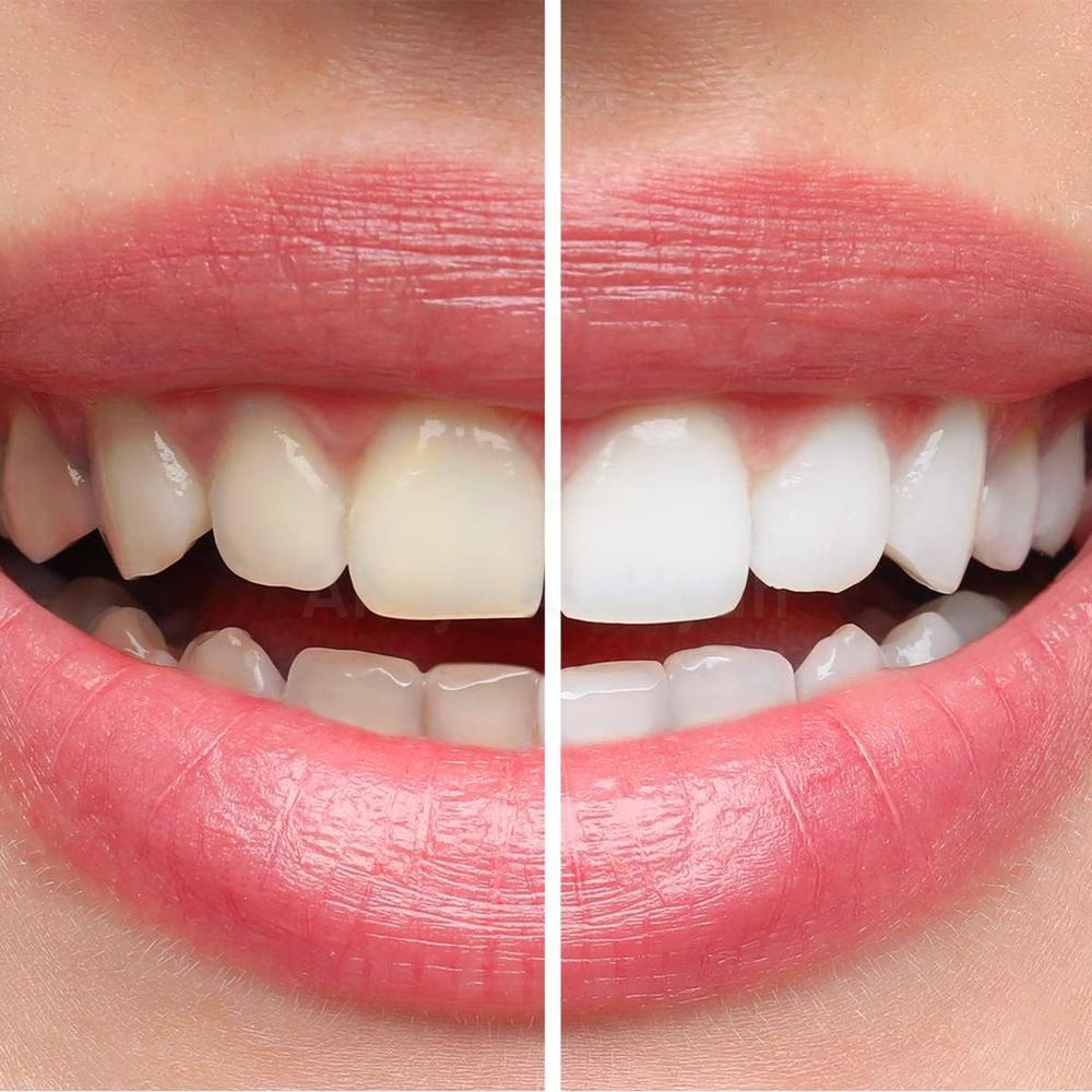PRESIDENT WHITE TOOTH PASTE 75ML #16009 3