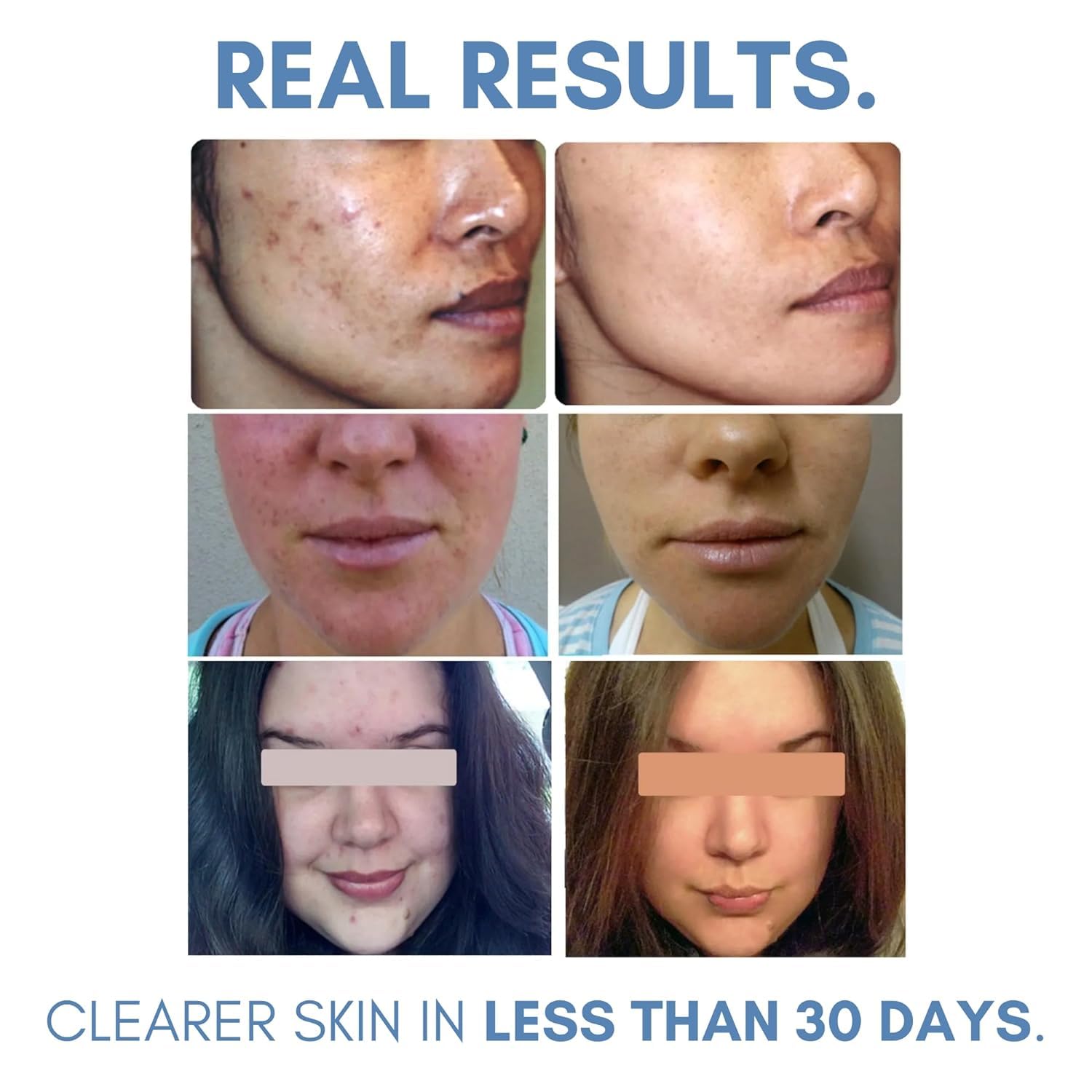 CLEAROGEN SULPHUR 3% LOTION 55ML 2