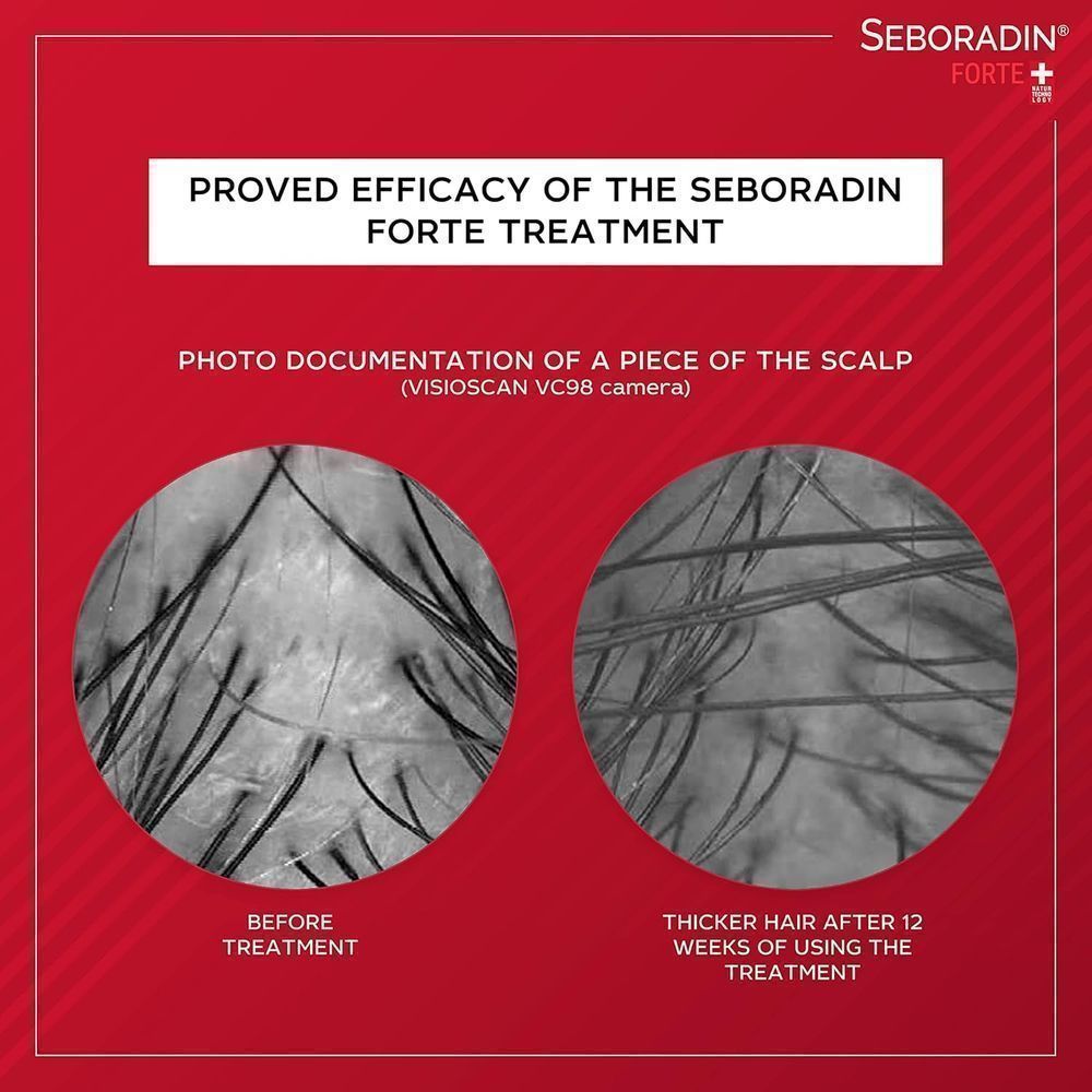 SEBORADIN ANTI HAIR LOSS LOTION 200ML #15552 10