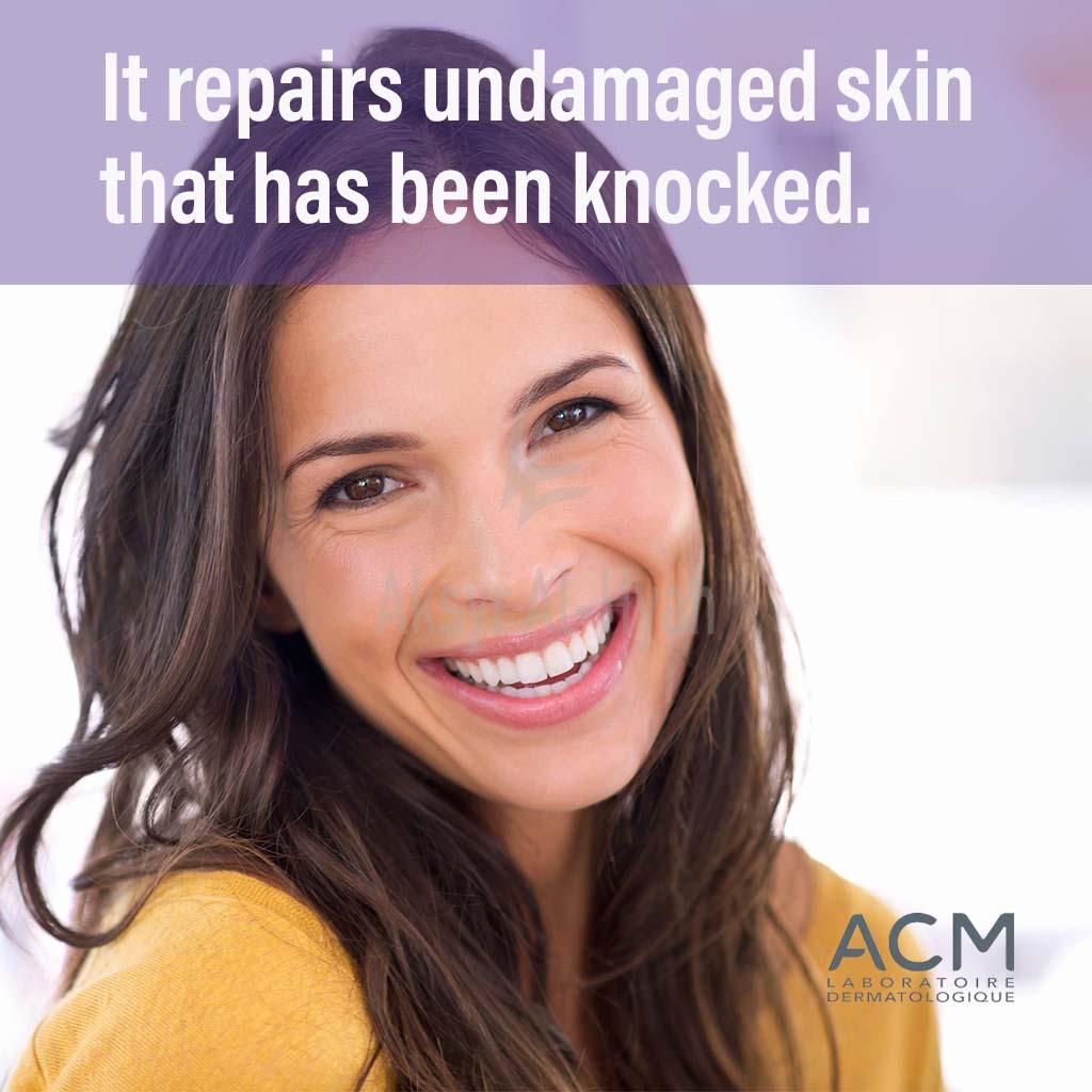 ACM CICASTIM ARNICA  CREAM 20ML #14683 5