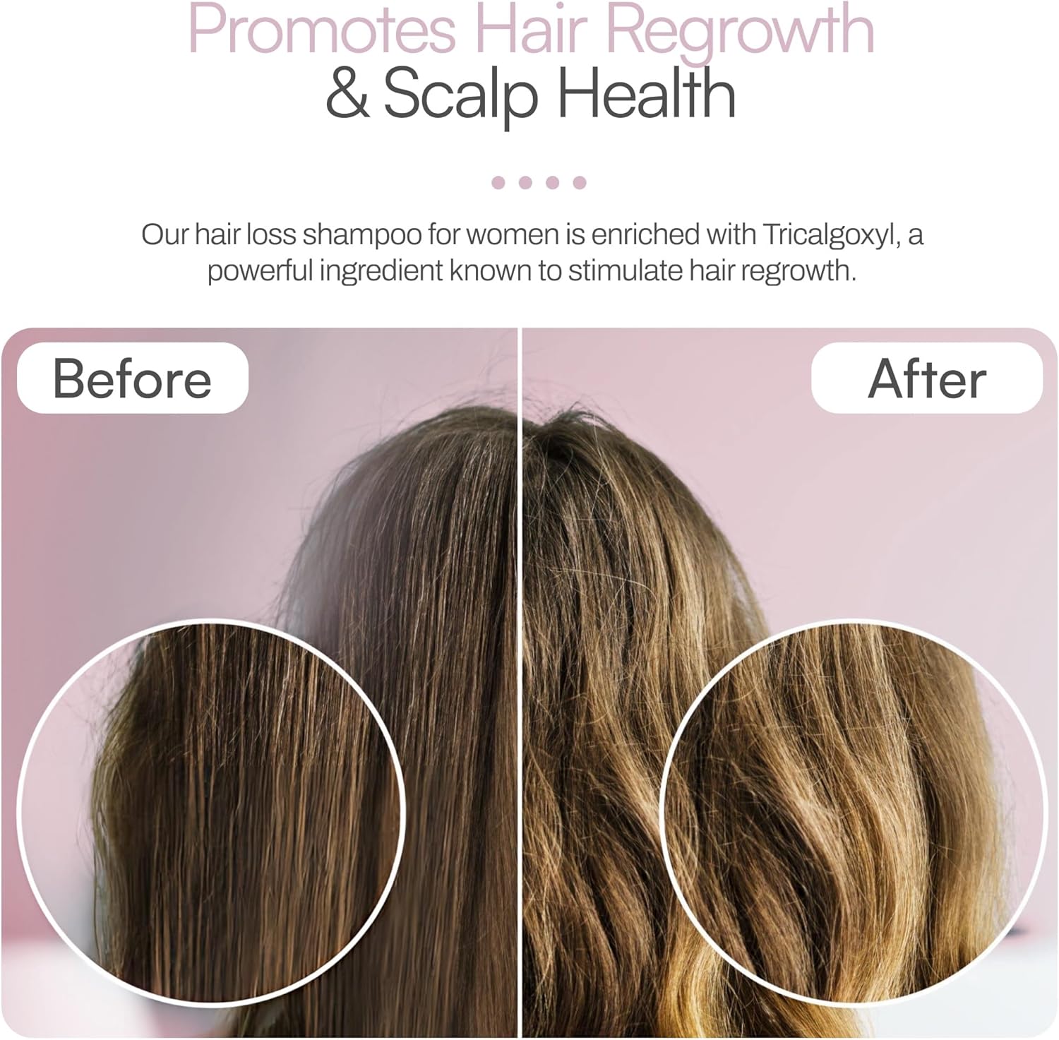 FOLTENE THINNING HAIR SHAMPOO FOR WOMEN 200ML 5