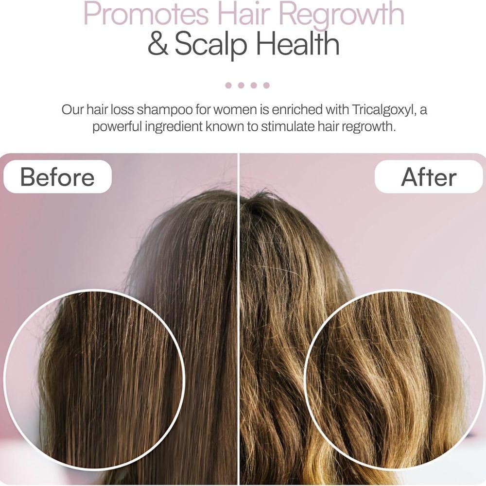 FOLTENE THINNING HAIR SHAMPOO FOR WOMEN 200ML 11