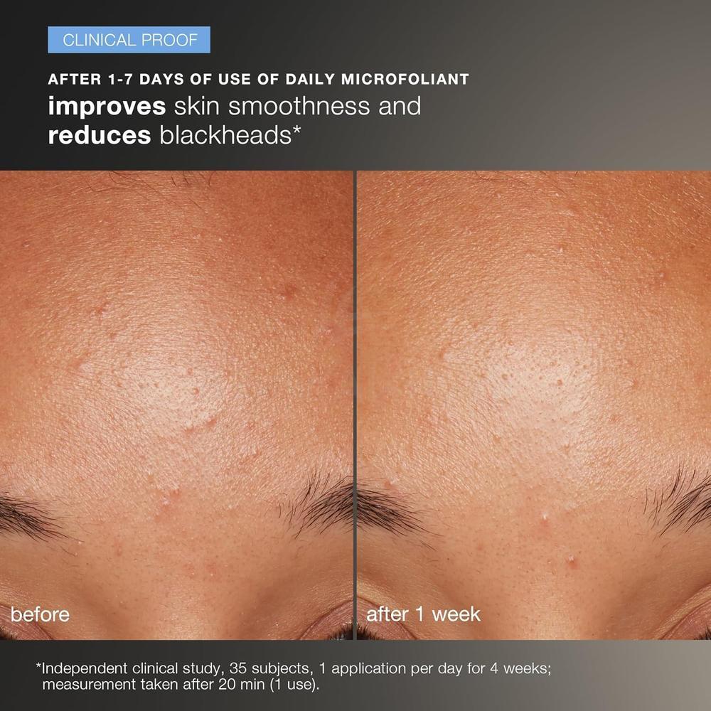 DERMALOGICA DISCOVER HEALTHY SKIN KIT#19194