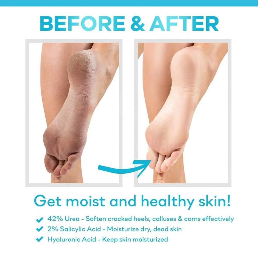 CERAVE SA RENEWING FOOT CREAM 88ML#FM25411