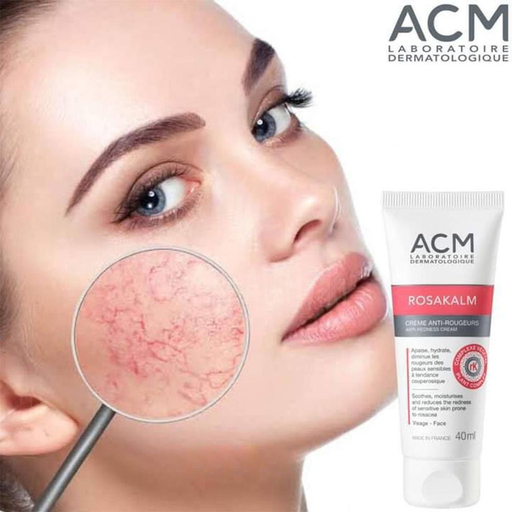 ACM ROSAKALM REDNESS CREAM 40ML #17672 5
