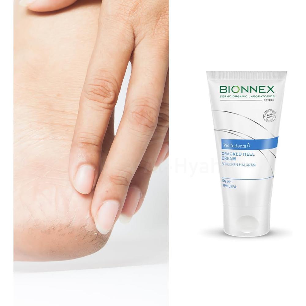 BIONNEX CRACKED HEEL CREAM 50ML #18892 1