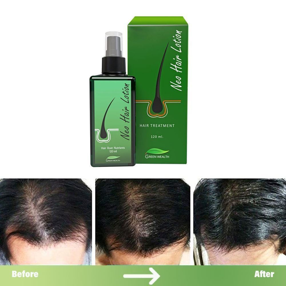 NEO HAIR LOTION 120ML 6
