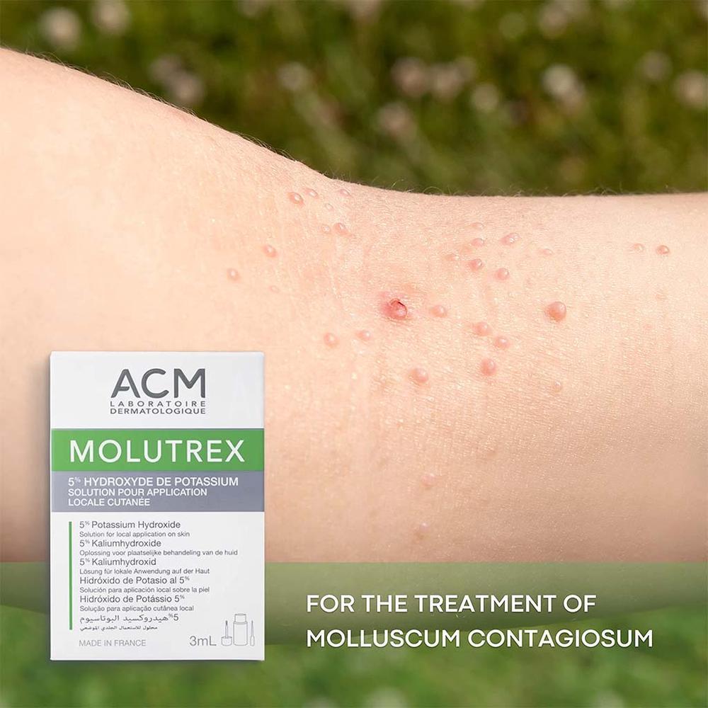 ACM MOLUTREX 3ML#19523 4
