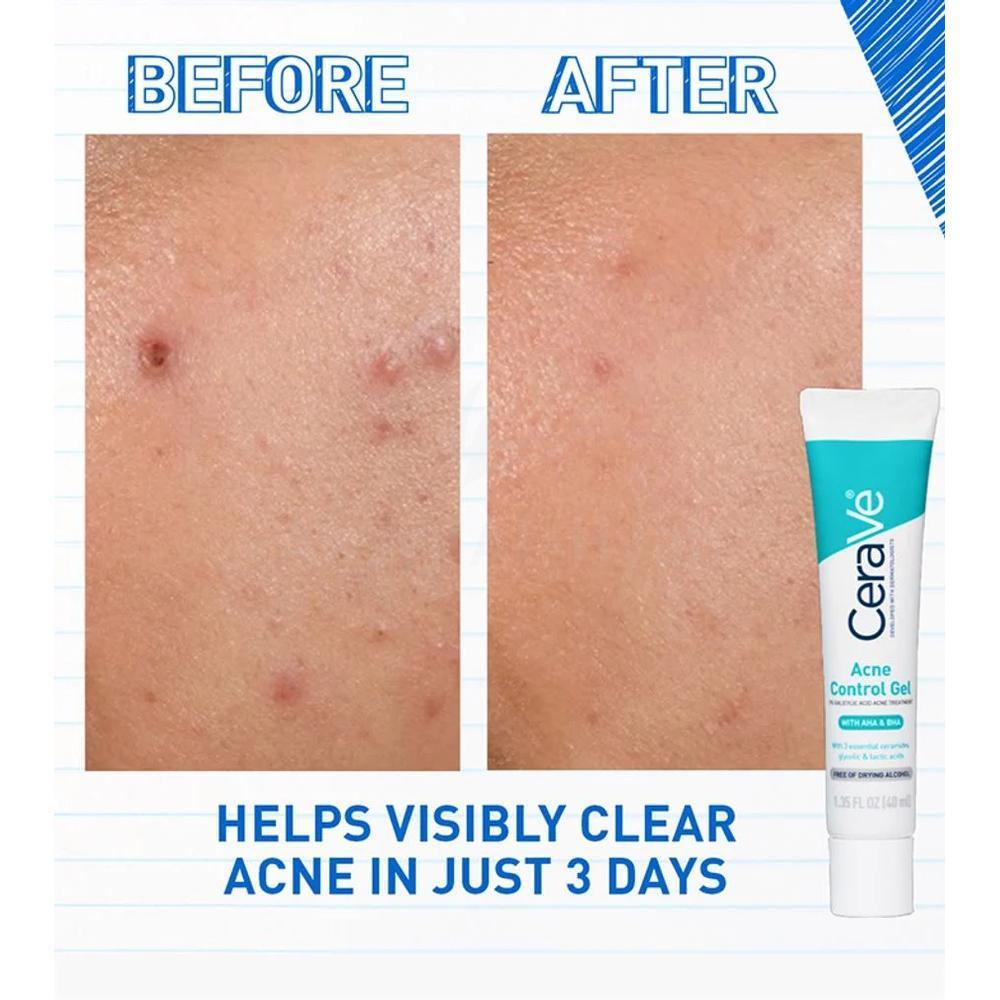 CERAVE BLEMISH CONTROL GEL 1.35ML#FM27657 2