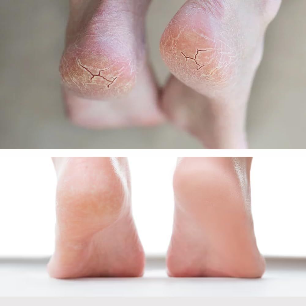PFC BALANCE DERMA REPAIR FEET CREAM 75ML#19322 8