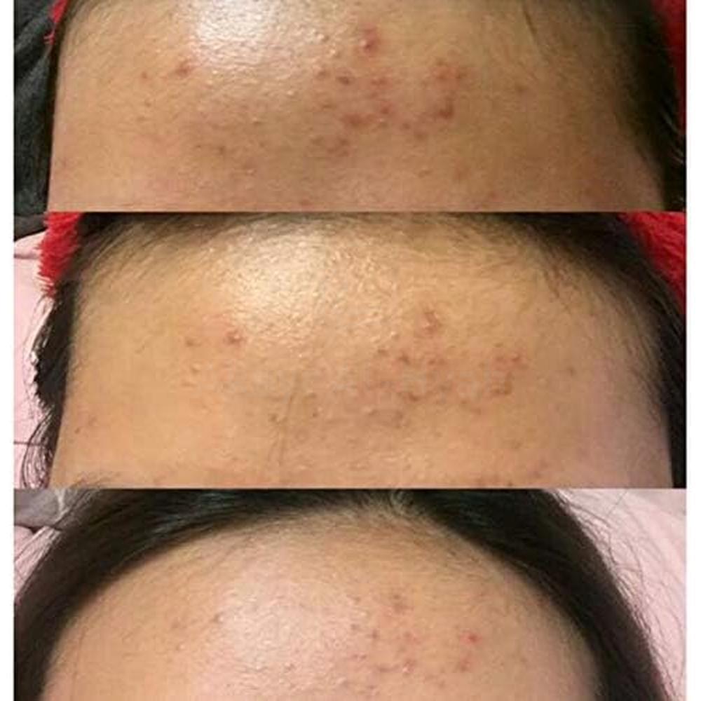 THE ORDINARY SALICYLIC ACID 2% SOLUTION 30ML 1