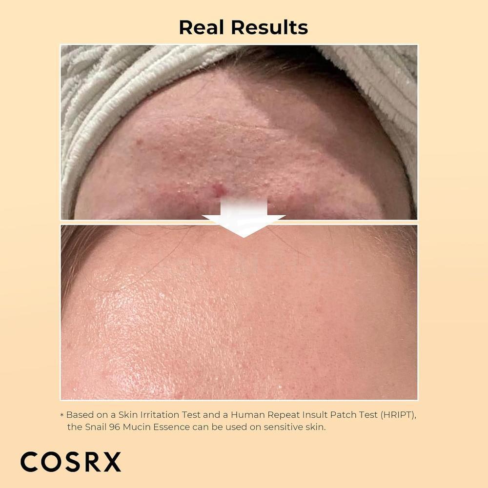 COSRX ADV SNAIL 96 MUCIN POWER ESSENCE 100ML 1