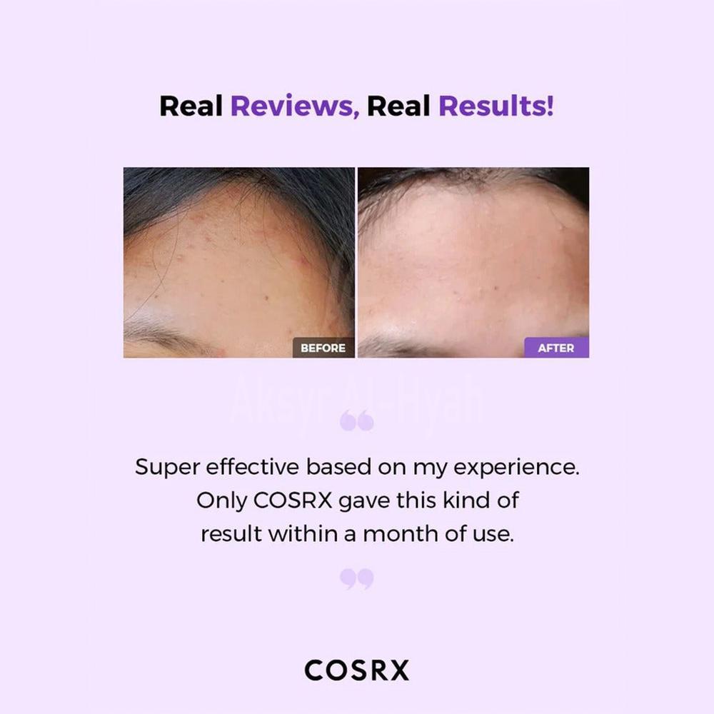 COSRX AHA/BHA CLARIFYING TREATEMENT TONER 150ML 4