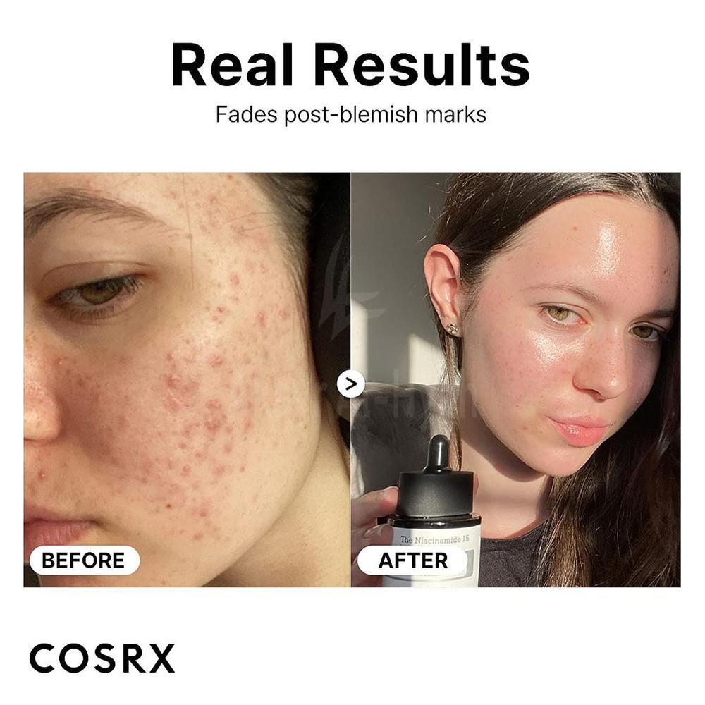 COSRX THE NIACINAMIDE 15 SERUM 20ML 3