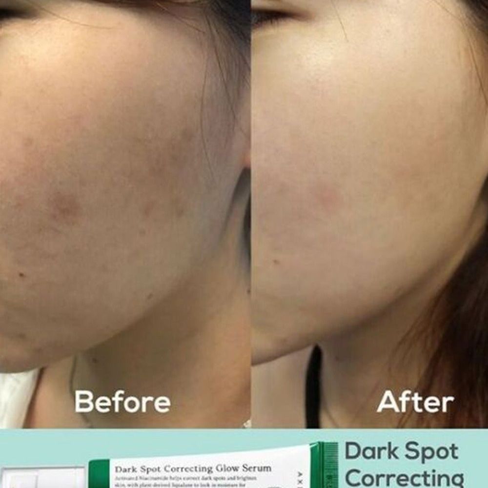 AXIS-Y DARK SPOT CORRECTING GLOW SERUM 50ML