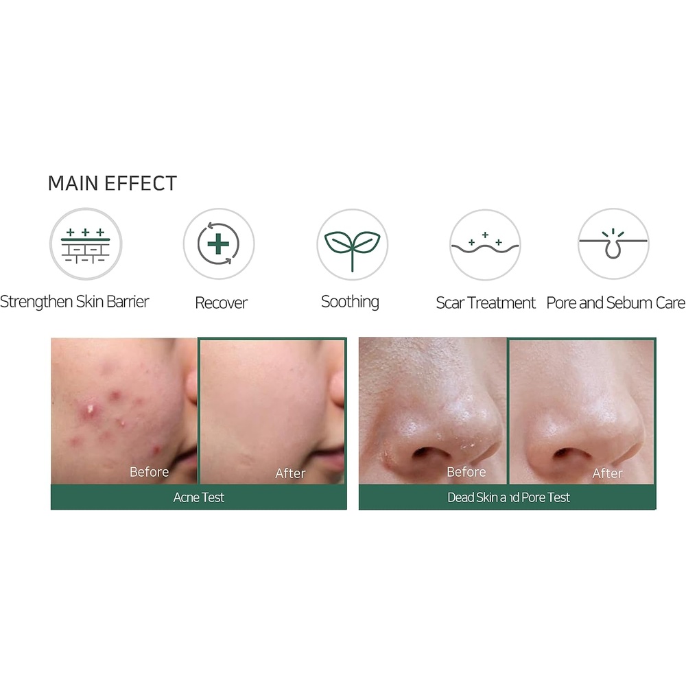 SOME BY MI AHA.BHA.PHA 30 DAYS MIRACLE CREAM 60G 4