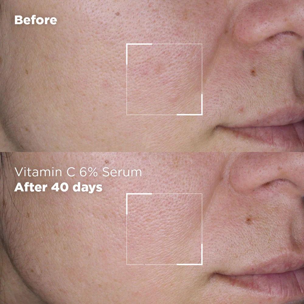 SKIN REPUBLIC VITAMIN C 6% SERUM 30ML 3