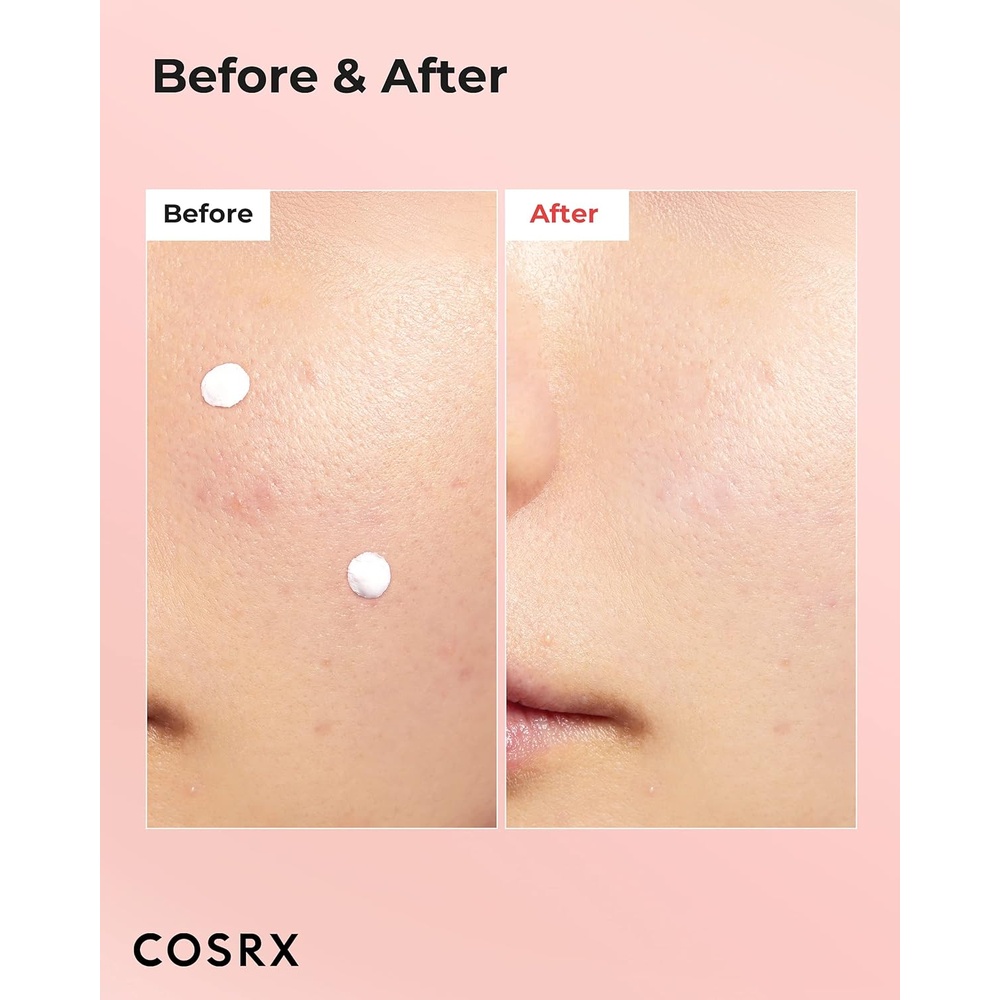 COSRX BLEMISH SPOT DRYING LOTION 30ML #589925 1